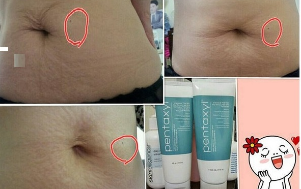 Pentaxyl stomach1, skincare