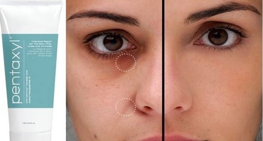 pentaxyl krém anti aging anti aging tudósok az evolúció ellen