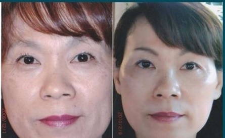 Cellular Rejuvenation Serum(2months)