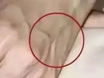 手上青筋越多，说明体内废物积滞的产物越多，尤其是女性一定要看！
