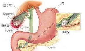 a68c774a-45e0-4123-a4c4-f39db3694f6b
